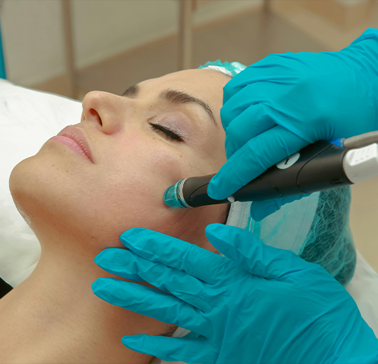 microdermabrasion facial treatment