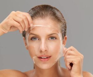 VI Chemical Peel